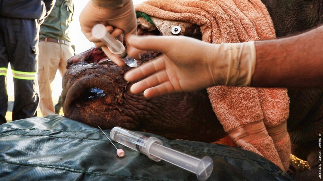 Nerve Block Nerve Block