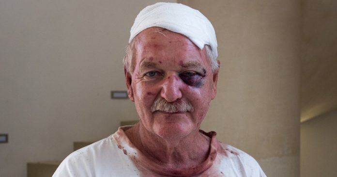 brutal-farm-attack-survivor