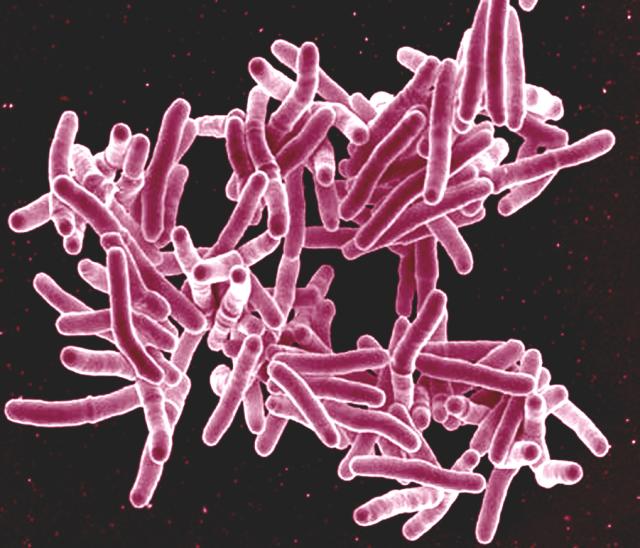 Mycobacterium_tuberculosis