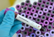 Coronavirus Blood Test South Africa