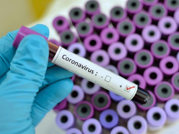 Coronavirus Blood Test Coronavirus Blood Test South Africa