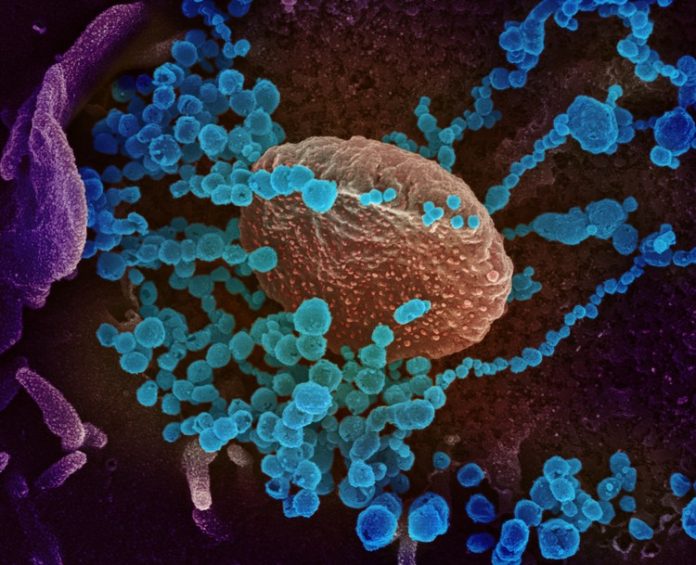 coronavirus-49557550751_c1f7f420b5_o_extra_large