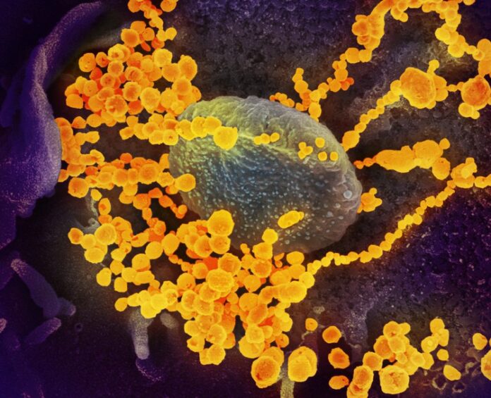 sars-cov-2_scanning_electron_microscope_image_extra_large This electron microscope image shows SARS-CoV-2 (round gold objects) emerging from the surface of cells cultured in a lab. Image: NIAID-RML (CC BY 2.0)