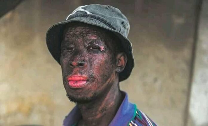 zikhaya sithole zikhaya sithole