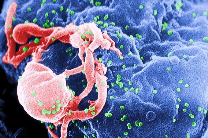 The image is an electron micrograph of HIV (coloured in green) budding from a lymphocyte. Taken by C. Goldsmith for the CDC, via Wikipedia. The image is an electron micrograph of HIV (coloured in green) budding from a lymphocyte. Taken by C. Goldsmith for the CDC, via Wikipedia.