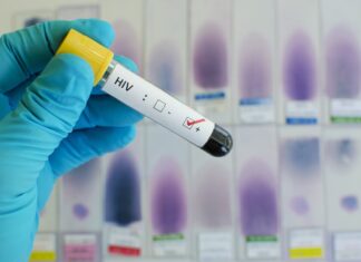 hiv