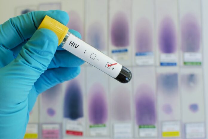hiv hiv