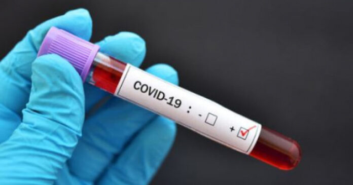 south-african-covid-update Gauteng recorded the highest number of deaths in the last 24 hours after 225 succumbed to the respiratory disease, followed by KwaZulu-Natal with 218, Eastern Cape with 134, while 128 occurred in the Western Cape.
