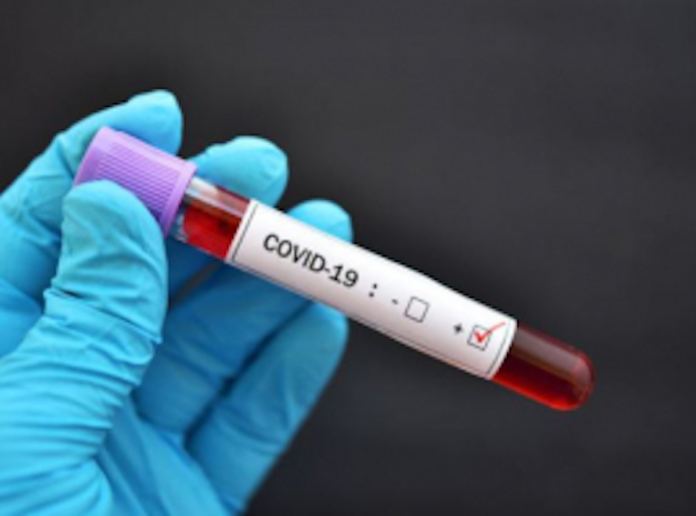 COVID-19 Test SA detects over 15 400 new COVID-19 cases