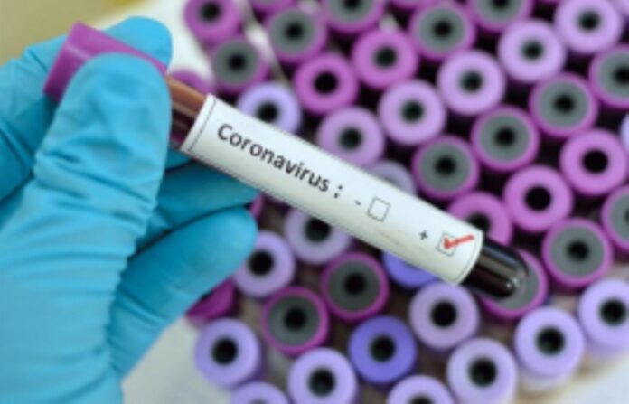 coronaviruspositivetest