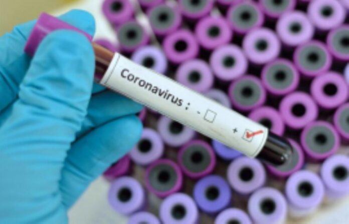 coronaviruspositivetest coronaviruspositivetest