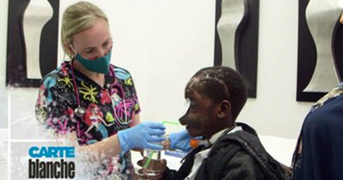boy-face-bitten-hyena-Carte-Blanche-Sunday Boy Mauled by Hyena Recovering