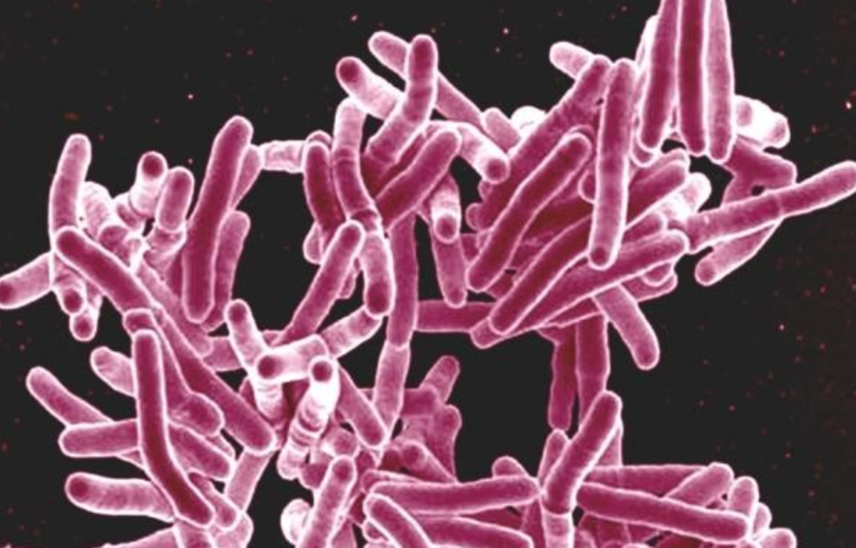 Life-saving TB drug is now cheaper in South Africa