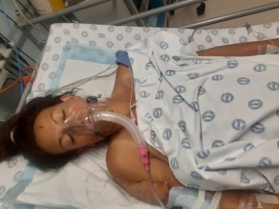 Due to the damage to Charlene’s pelvis, she has lost the function of her left leg and faces a long road to recovery.