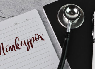 Monkeypox Q and A