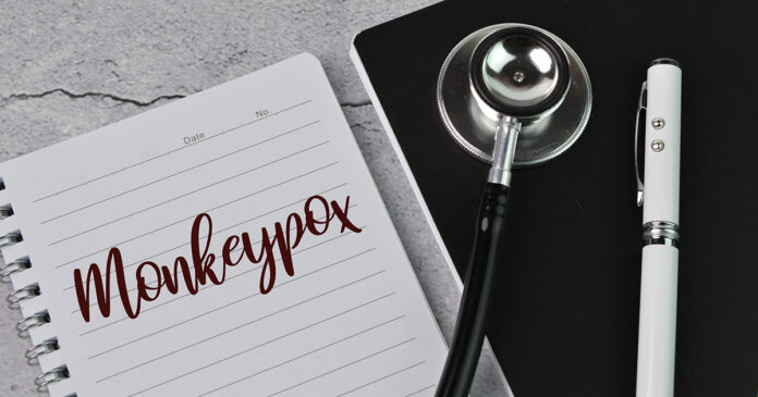 monkeypox Q and A Monkeypox Q and A