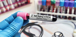 Monkeypox South Africa