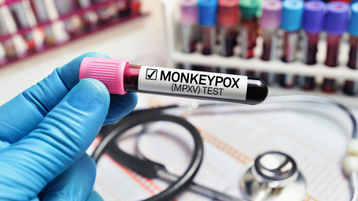monkeypox-South-Africa-th-istock Monkeypox South Africa