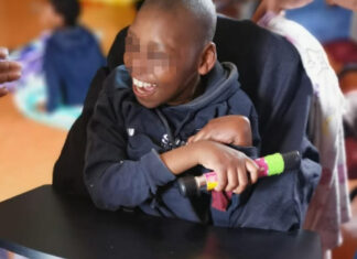 Rats eating children in rural Transkei