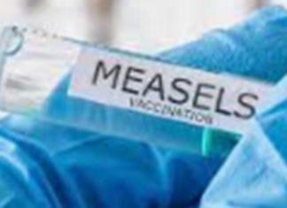 Measles outbreak declared in Cape Town