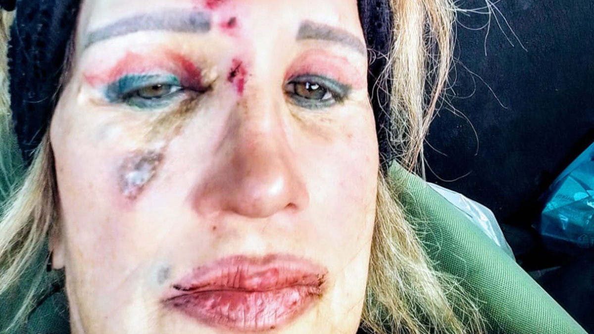 Attackers chant “Kill the Boer, kill the Farmer” before stabbing female victim with spear